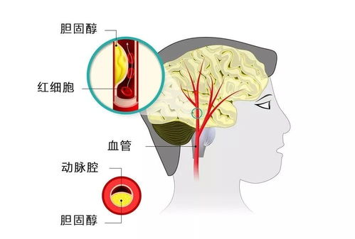阴虚和阳虚的区别和表现 阴虚和阳虚的区别和表现
