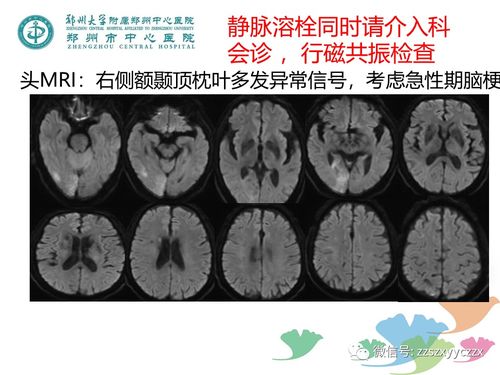 冠心病慢病病历 冠心病病历书写规范 冠心病慢病病历 冠心病病历书写规范