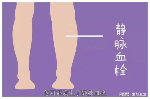 心脏会导致腹泻 心脏犯病会拉稀么 心脏会导致腹泻 心脏犯病会拉稀么