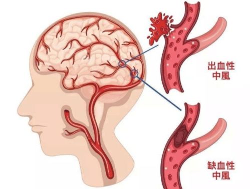 ��Ѫѹ��ʲô�ܸ�����