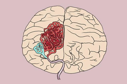 ��Ѫѹ���˳Ժ����� ��Ѫѹ�˳Ժ���ò���