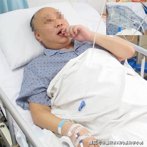 心脏不好应吃什么好药 心脏不好应吃什么好药