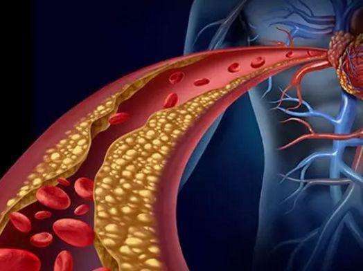 心脏造影主动脉在哪里 心脏造影主动脉在哪里