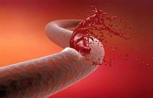 ���˸�Ѫѹ������β�