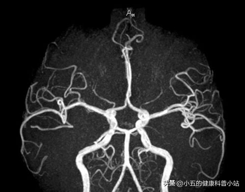 美食的俘虏之食者无敌 美食的俘虏之食者无敌