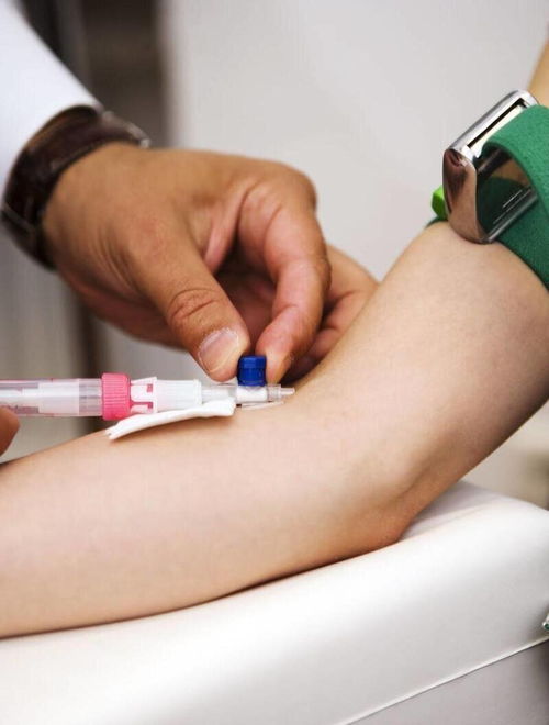 大姨妈来的时候可以吃香蕉吗 大姨妈来的时候可以吃香蕉吗