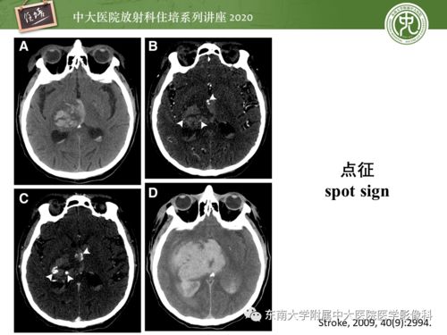 林俊杰教主_林俊杰教主陈冠希护法 林俊杰教主_林俊杰教主陈冠希护法