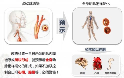 ����һֱ�����Ǹ�Ѫѹ��