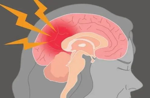 ��ѪѹС����ʹ ��ѪѹС�Զ�����ʲô֢״