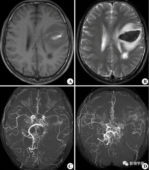 先天性心脏手术时间表格 先天性心脏手术时间表格