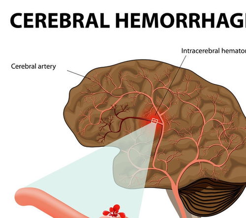 抗焦虑药物吃了心脏难受 抗焦虑药物吃了心脏难受