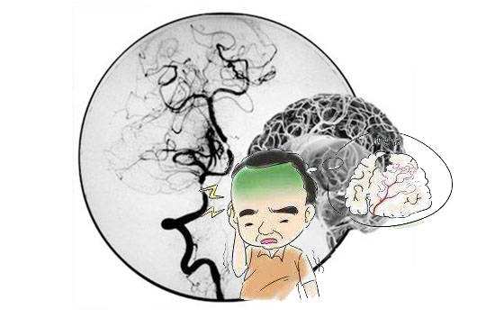 来月经为什么头疼恶心 来月经为什么头疼恶心