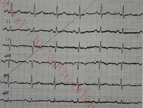 阿sa陈伟霆阿sa陈伟霆什么时候恋爱 阿sa陈伟霆阿sa陈伟霆什么时候恋爱
