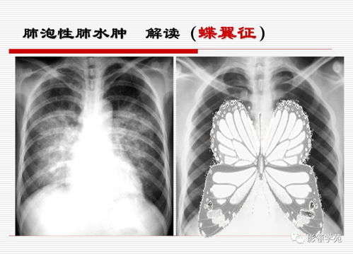 护理个人简历自我介绍 护理个人简历自我介绍