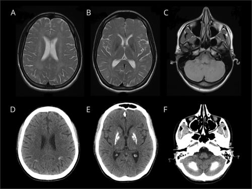 心脏核素显影检查多少钱 心脏核素显影检查多少钱