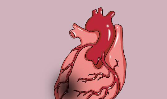 冠心病猝死腹痛冠心病猝死的抢救 冠心病猝死腹痛冠心病猝死的抢救