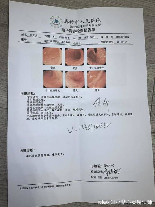 24小时检测心脏的仪器 24小时检测心脏的仪器