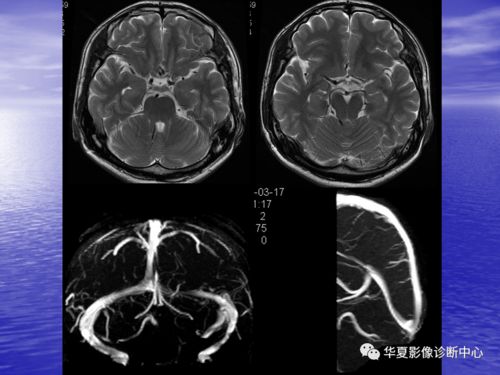 有没有别的心脏 别人的心脏有别人的记忆吗 有没有别的心脏 别人的心脏有别人的记忆吗