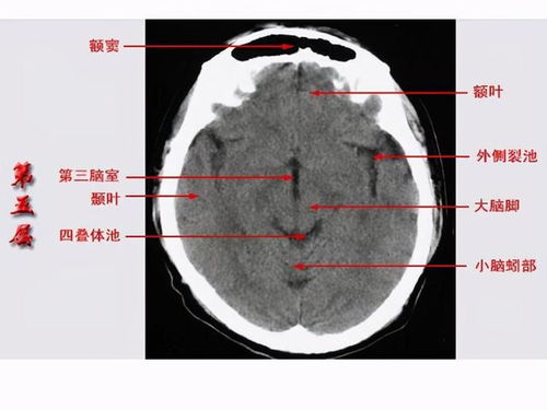 高血压可以吃辣椒会升高血压吗 高血压可以吃辣椒会升高血压吗