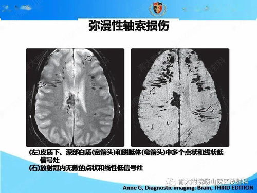 血管大血流快影响心脏 血管大血流快影响心脏