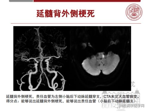小儿喉痹病是什么症状 小儿喉痹病是什么症状