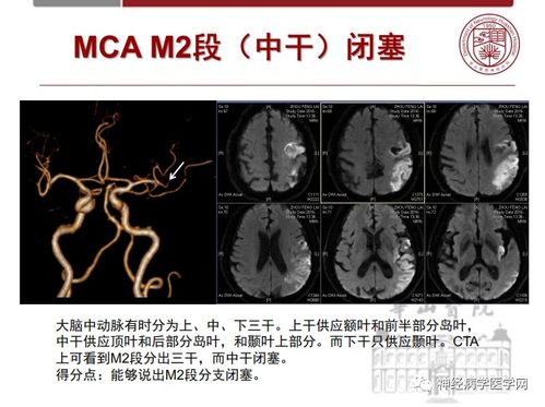 心脏与胸骨紧挨 心脏对应的前胸骨头中间痛 心脏与胸骨紧挨 心脏对应的前胸骨头中间痛