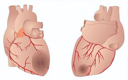 ��Ѫ���Ѽܺ�ע��ʲô