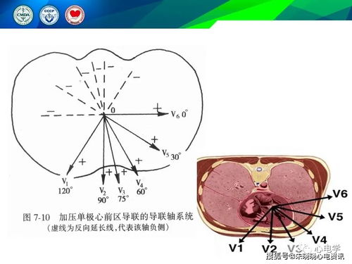 病毒性扁桃体炎怎么治 病毒性扁桃体炎怎么治