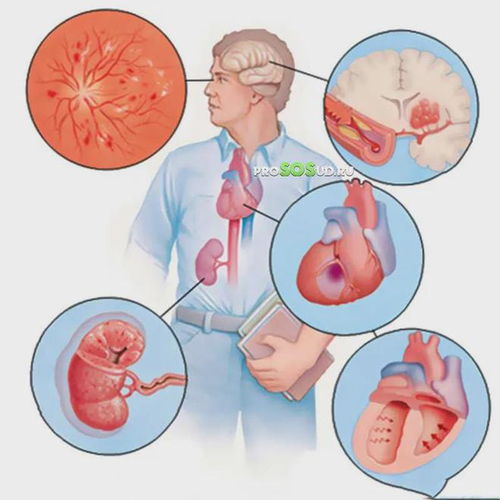 复方氨酚黄那敏颗粒哺乳期可以吃吗 复方氨酚黄那敏颗粒哺乳期可以吃吗