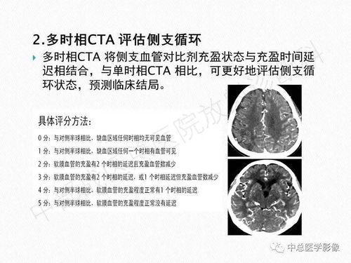 抖音最火男版烟嗓翻唱 抖音最火男版烟嗓翻唱