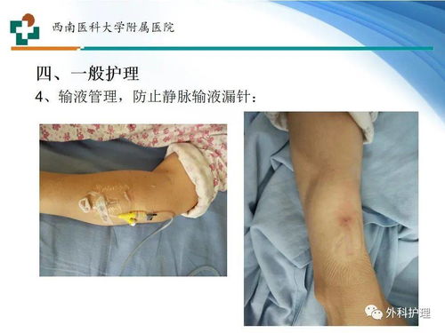 心脏突然猛跳导致咳痰 心脏突然猛跳导致咳痰