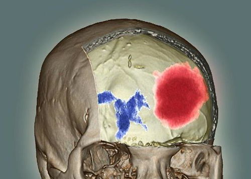 Ѫѹ׾Ƽ Ѫѹ˺ʲôİ׾ã