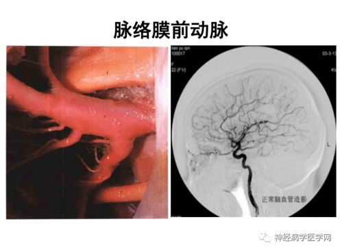 冠心病会头晕干呕吗_冠心病会恶心头痛吗 冠心病会头晕干呕吗_冠心病会恶心头痛吗