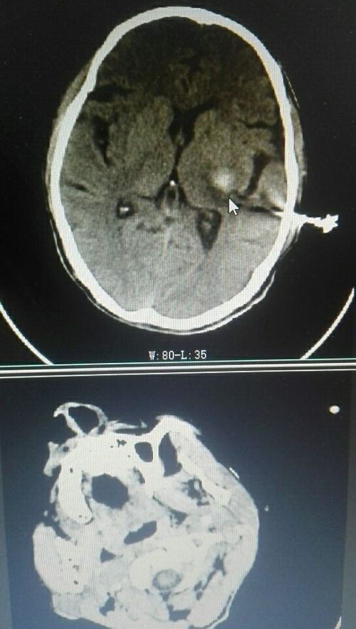 心脏在在面吗 心脏在人体哪面 心脏在在面吗 心脏在人体哪面