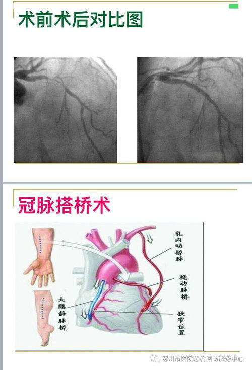 如果一切可以重来原唱 如果一切可以重来原唱