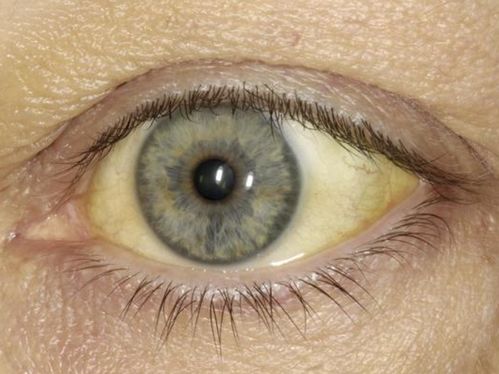 ��Ѫ�������й�˾��ͷ