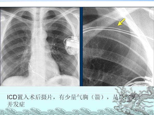 ��������Ѫ�ܼ�������