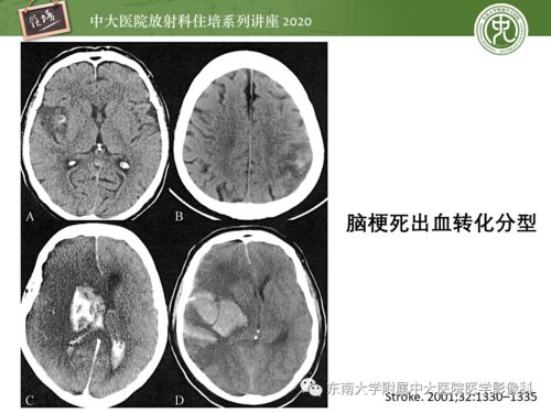 心脏过慢是(心脏过慢是怎么回事) 心脏过慢是(心脏过慢是怎么回事)