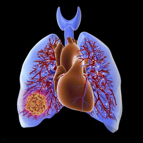 颈椎疼能针灸治疗吗 颈椎疼能针灸治疗吗