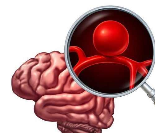 新疆心脏搭桥手术排名 新疆心脏搭桥手术排名