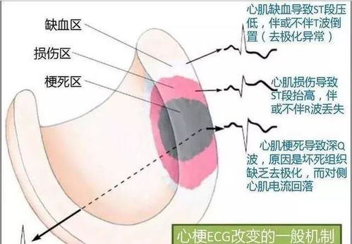 孕妇牙疼可以喝什么药 孕妇牙疼可以喝什么药
