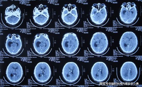 心脏与血液 心脏与血液循环思维导图 心脏与血液 心脏与血液循环思维导图