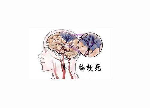 面条对心血管吃面条对血压升高有关吗 面条对心血管吃面条对血压升高有关吗