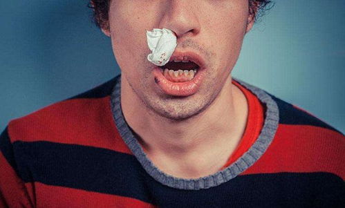 ���๩Ѫ�����ĸ�ҩ����