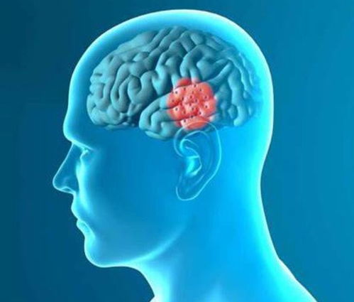 嗓子有异物感心脏疼 嗓子有异物感心脏疼吃什么药 嗓子有异物感心脏疼 嗓子有异物感心脏疼吃什么药