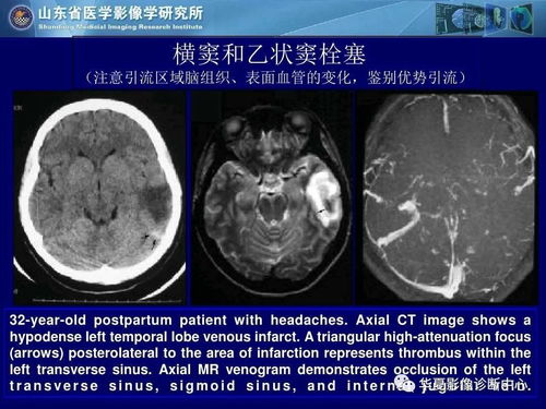 ��Щʳ�����շ����ಡ��