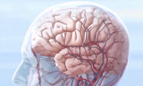 Ѫѹܳӽ(ѪѹȺʺϳ)