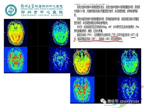 杨钰莹有哪些好听的歌 杨钰莹有哪些好听的歌