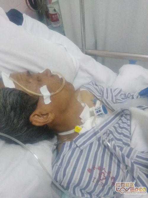 长期染发造成的心脏衰竭 长期染发造成的心脏衰竭