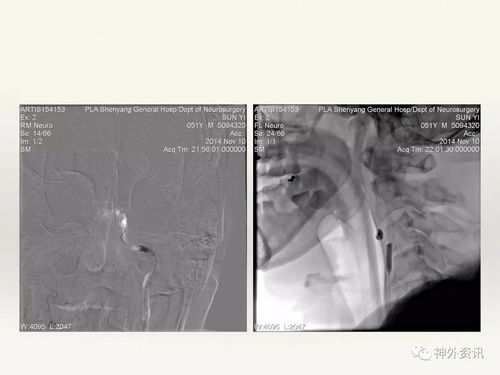 ���������Ѫ����Ҫ�ɿ���